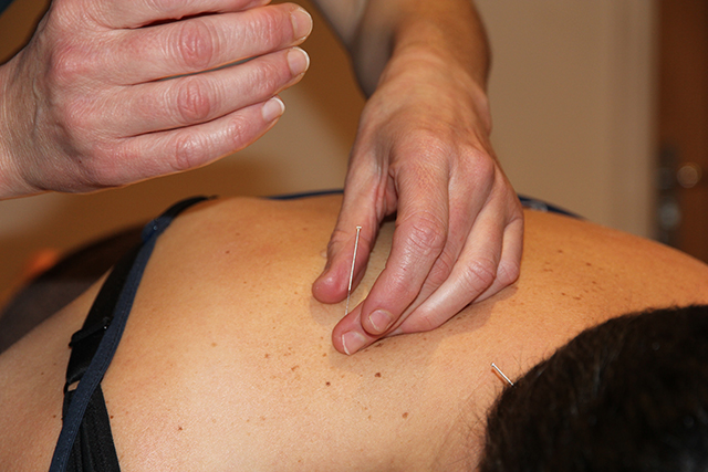 Sports Injury Massage in Hayle, Cornwall