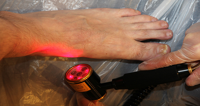 Laser Therapy Treatment Cornwall