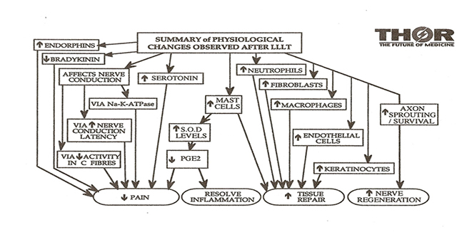 Laser Therapy in Hayle, Cornwall
